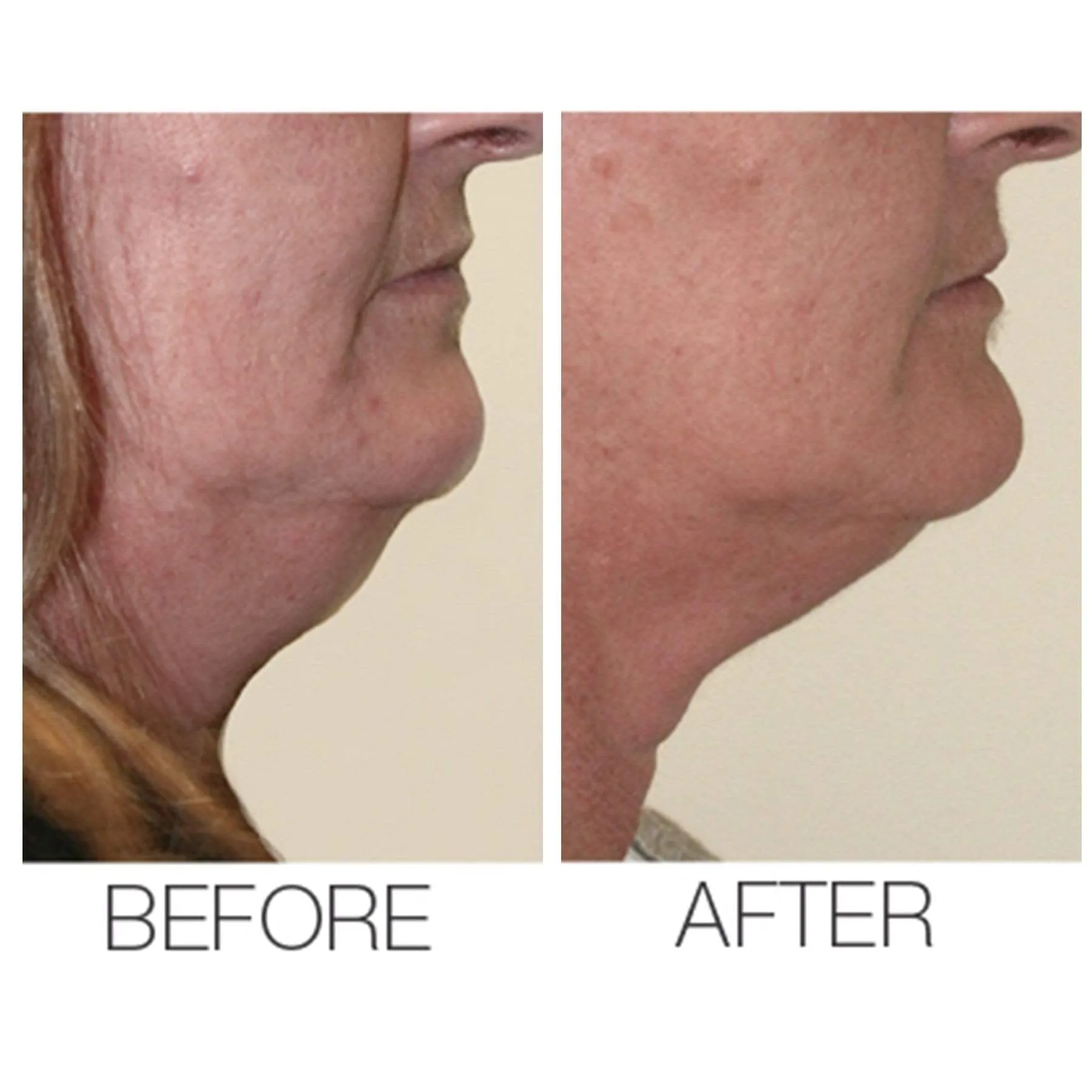 Best Selling Velvet Maxi Lift Airbrush Foundation   Maxisculpt Collagen Primer  Filler